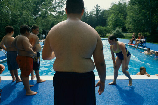 Günümüzün Sorunu Çocuklukta Obezite