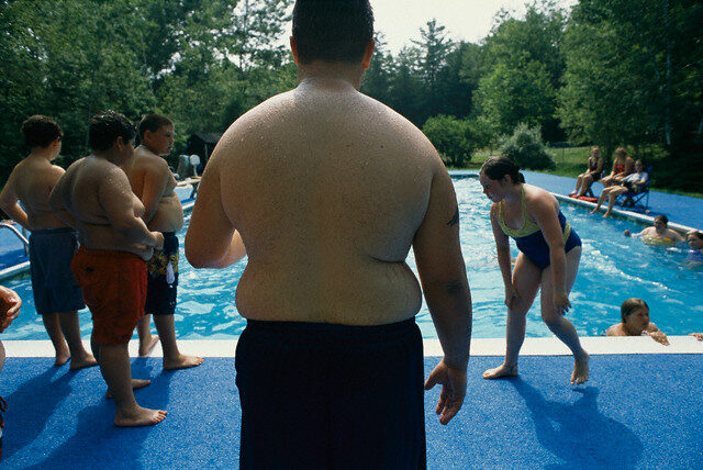 Günümüzün Sorunu Çocuklukta Obezite